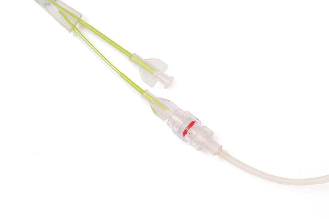 CE Medical Ureteral Balloon Dilatation Catheter Solve Urinary Obstruction